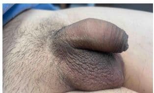 Patient U — clinical photograph 4 of 4