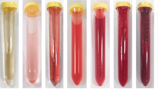 Multiple urine sample tubes showing different colors